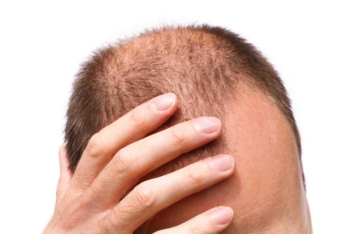 Foligain d5 е продукт, който стимулира растежа на косата, помага при оплешивяване