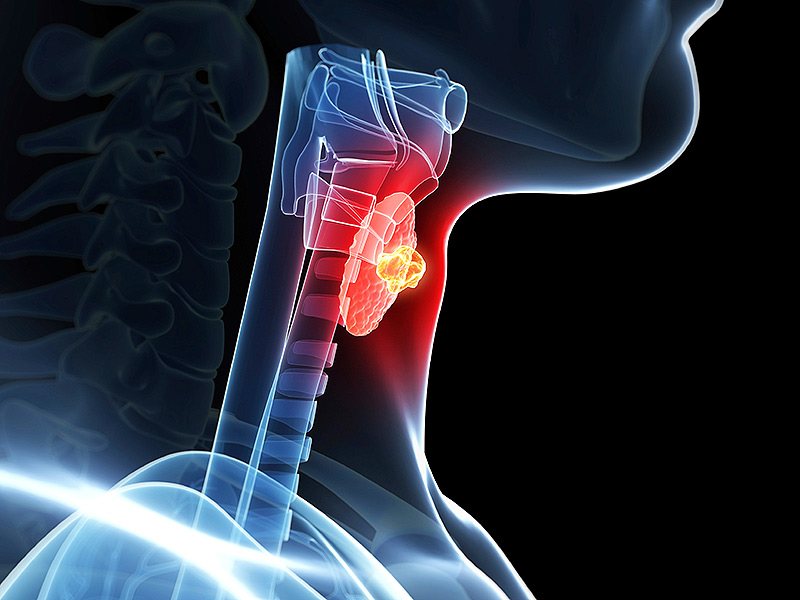 Йод подобрява функцията на щитовидната жлеза и предотвратява появата на ендемична гуша.