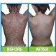 SAL-033045 - Dermaspray Intensive 100 ml в категория Псориазис.