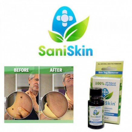 SAN-00503 - Sani Skin в категория . Sani Skin за премахване на