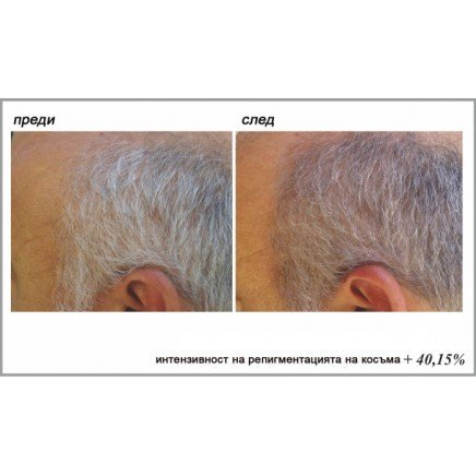 TEL-115466 - Stop Gray Hair в категория . Stop Gray Hair Препятства