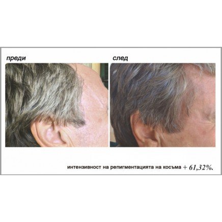 TEL-115466 - Stop Gray Hair в категория . Stop Gray Hair Препятства