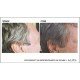 TEL-115466 - Stop Gray Hair в категория . Stop Gray Hair Препятства