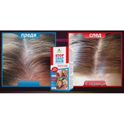 TEL-115466 - Stop Gray Hair в категория . Stop Gray Hair Препятства