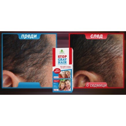 TEL-115466 - Stop Gray Hair в категория . Stop Gray Hair Препятства