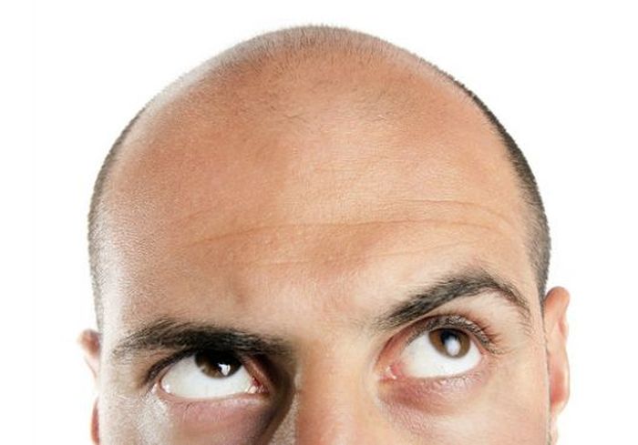 Миноксидил пяна 5% е средство срещу косопад за мъже, което стимулира растежа на нова коса и спира оплешивяването.