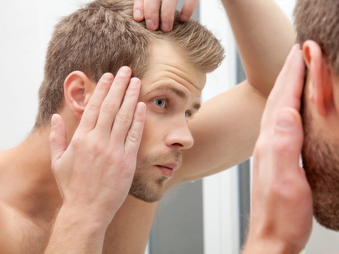 Мъжете с напредването на възрастта започват да губят много коса и да оплешивяват.