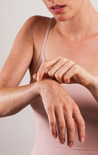 Контактен дерматит е вид екзема, причинена от дразнител или алерген, към който кожата е чувствителна, необходим е крем за екзема и дерматит.