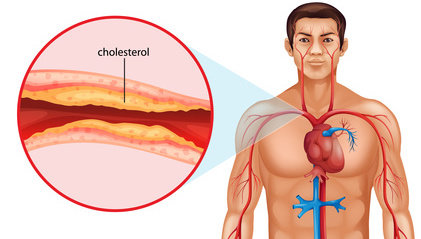Healthy Cholesterol- Improved Formula на топ цена предпазва от запушване на артериите и помага при сърдечни заболявания